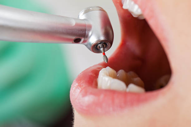 Best Weekend Emergency Dentist in Airport, CA